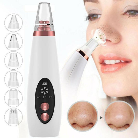 Blackhead Pore Vacuum Cleaner: Does It Really Work for Clearer Skin?